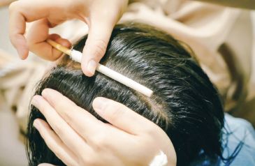 Moclock Scalp Scaling